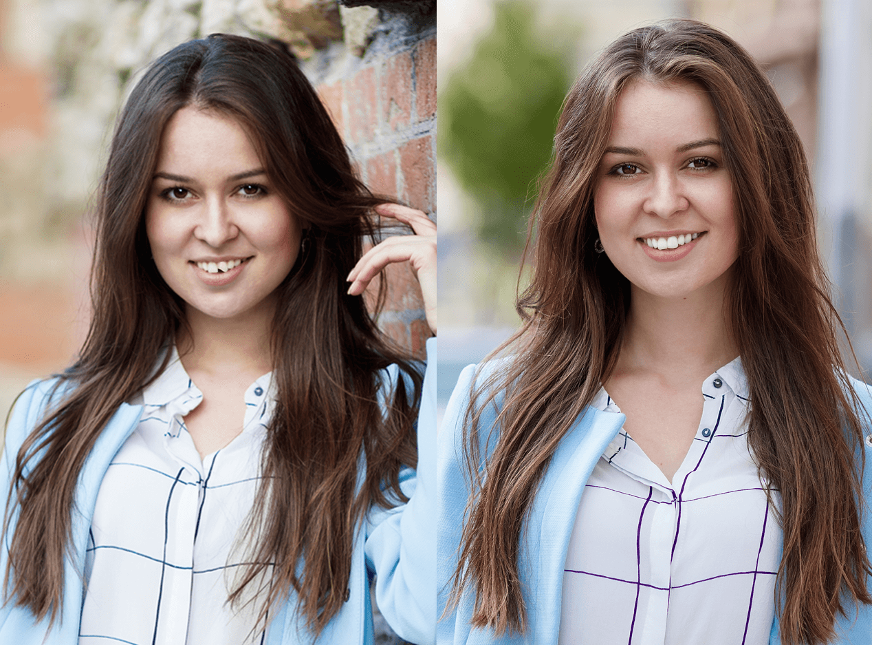 Реставрація зуба